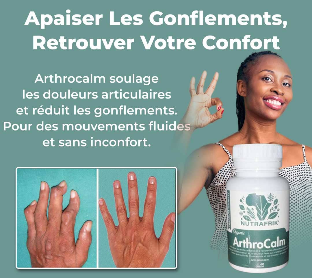 ArthroCalm™ Capsules pour l'inflammation et les Douleurs Articulaires - (60 Capsules)