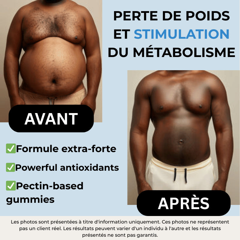 FATBURNER™ Gummies Pour Brûler les Graisses Pendant le Sommeil